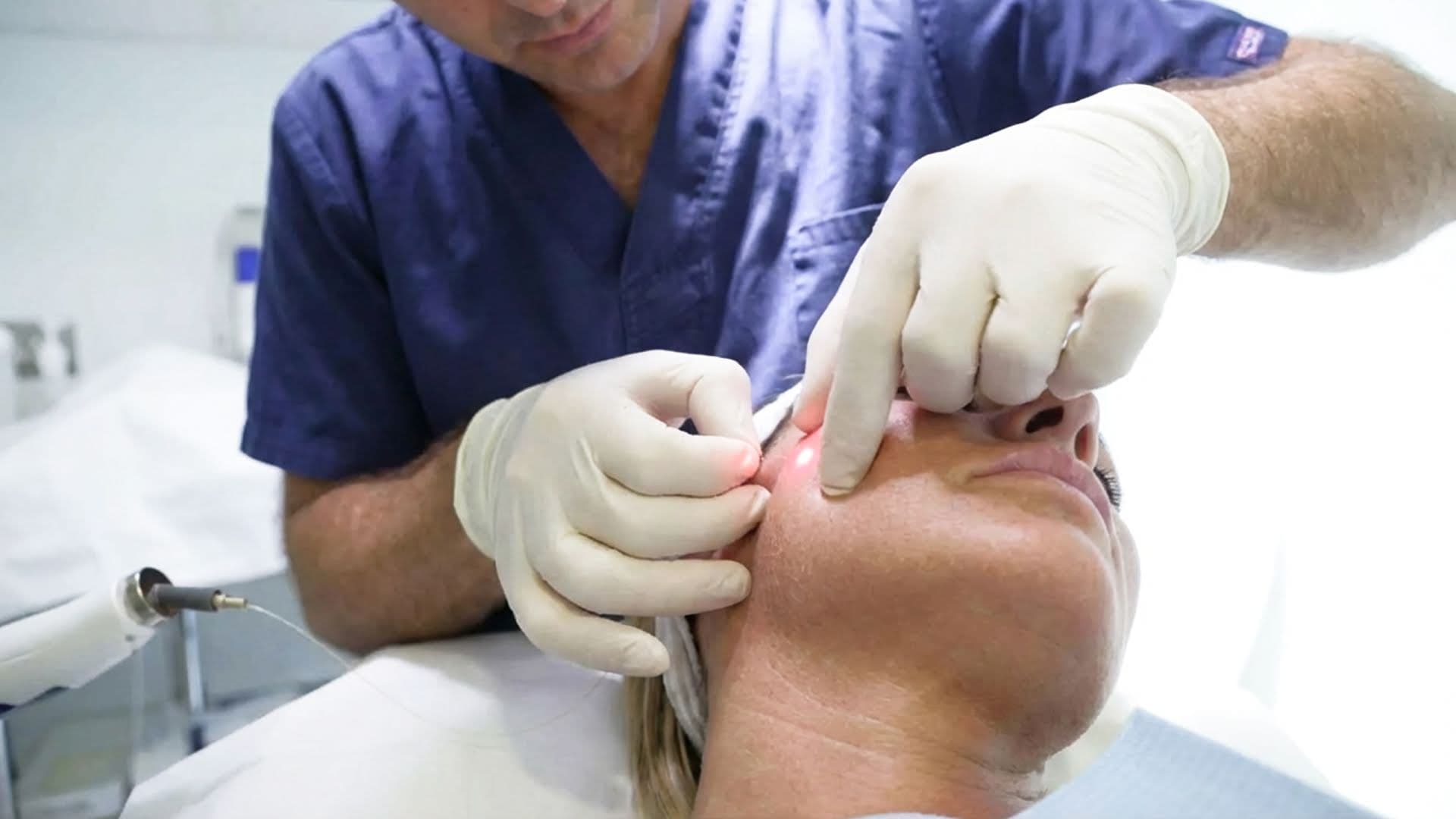 Endolift Premium Facial Lift