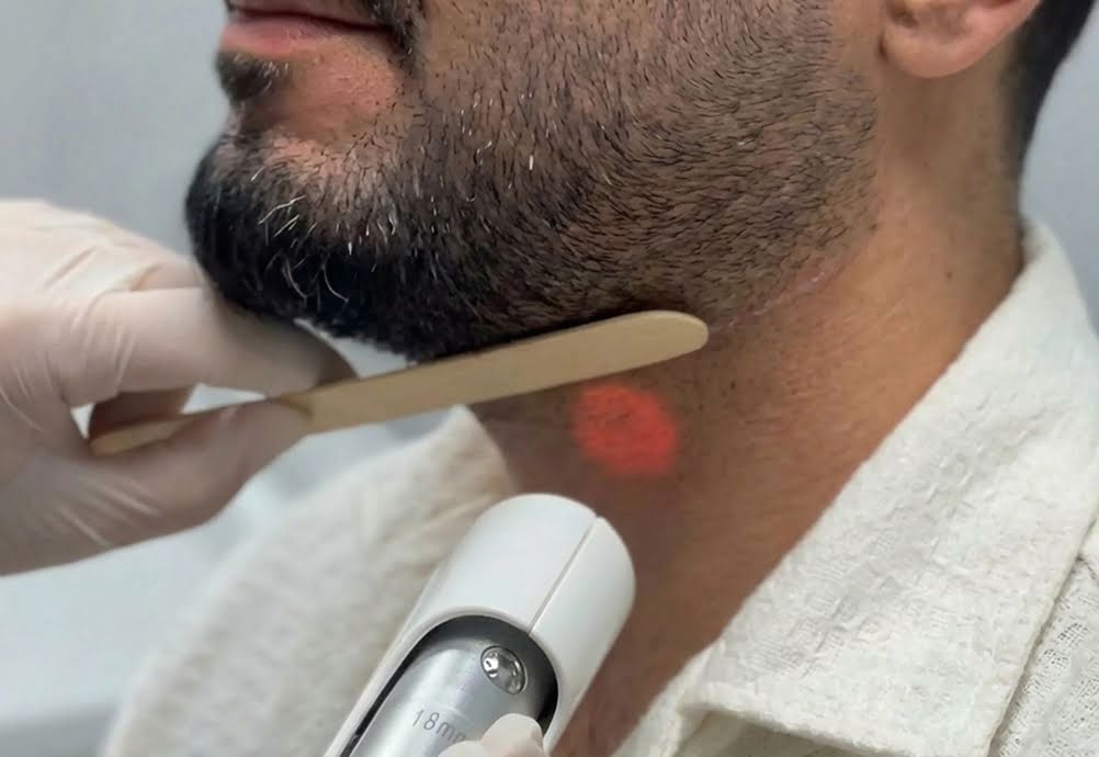 Power Groom – Men’s Full Body Laser at Swan Aesthetic Clinic, Dubai 3