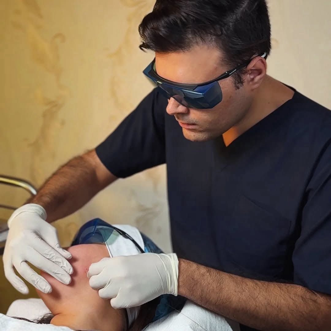 Endolift Premium Facial Lift 2