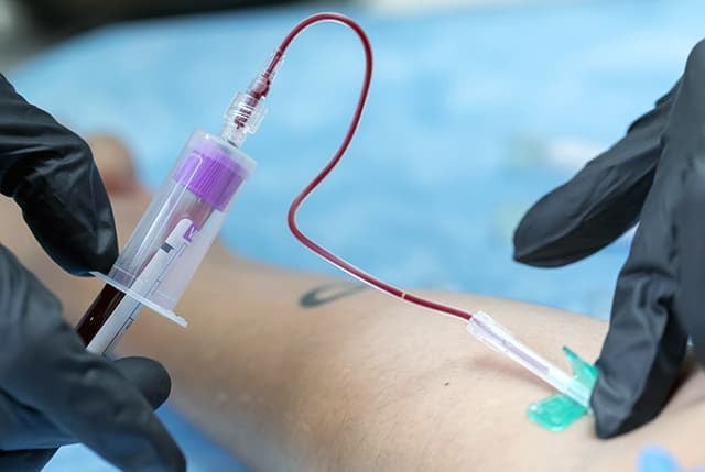 Comprehensive Health Screening for Men Above 40 Years 2