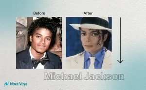 Michael Jackson nose job