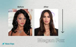 Megan Fox nose job