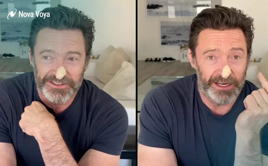Actor Hugh Jackman with a bandage on his nose after skin cancer removal.