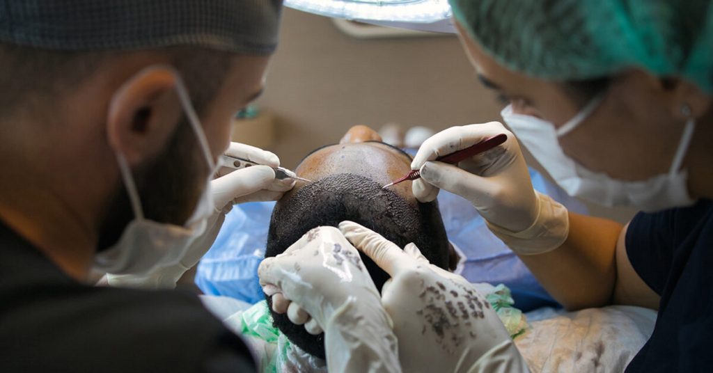 Natural-Looking Hair Transplant in Dubai for Executives