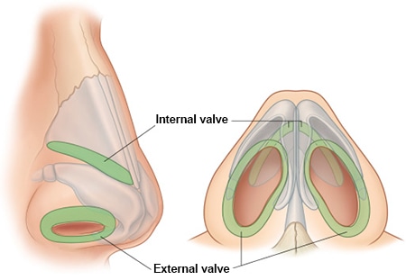 anatomy of nose - Internal valve + external valve