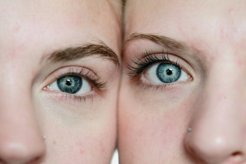 Blepharoplasty in Dubai: How to Choose the Right Clinic, Surgeon & Technique in 2026
