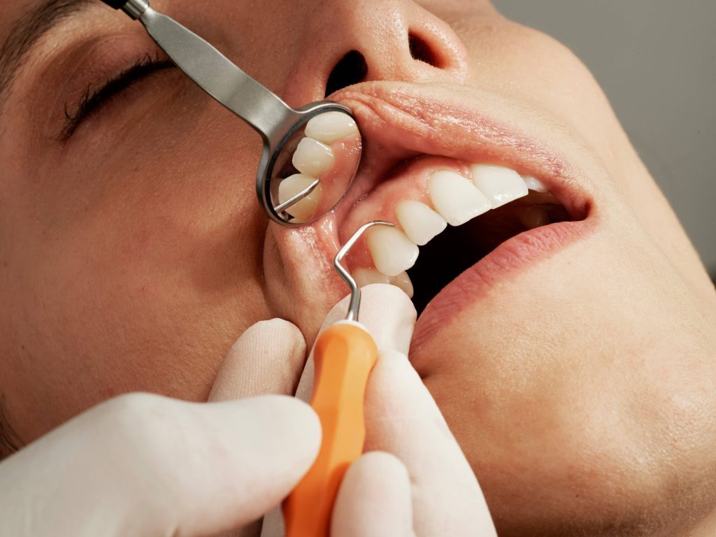 Advanced Gum Disease Treatment: 4 Science-Backed Methods That Can Save Your Teeth and Your Wallet