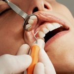 Advanced Gum Disease Treatment: 4 Science-Backed Methods That Can Save Your Teeth and Your Wallet