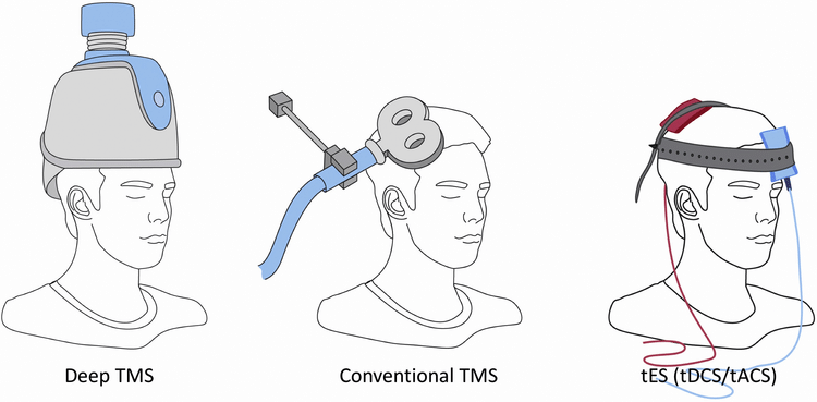 Three major non-invasive brain stimulation technologies