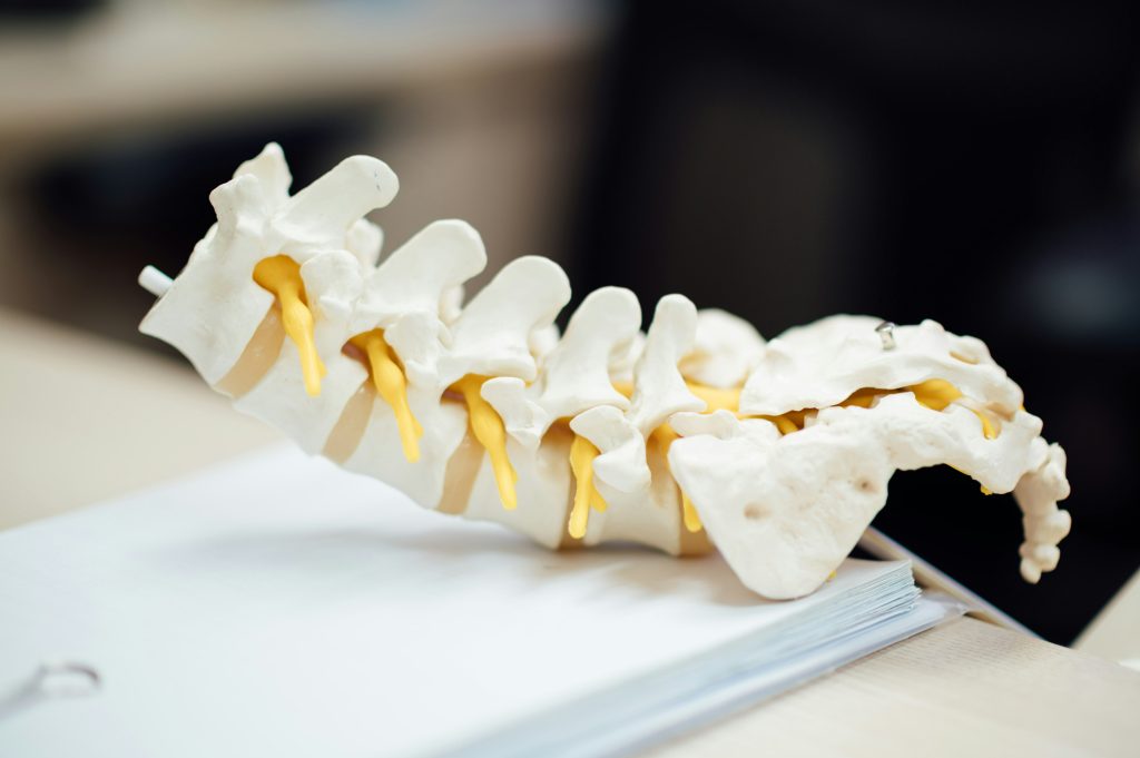 Had Spine Surgery But Still in Pain? Here’s What’s Really Going On