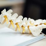 Had Spine Surgery But Still in Pain? Here’s What’s Really Going On